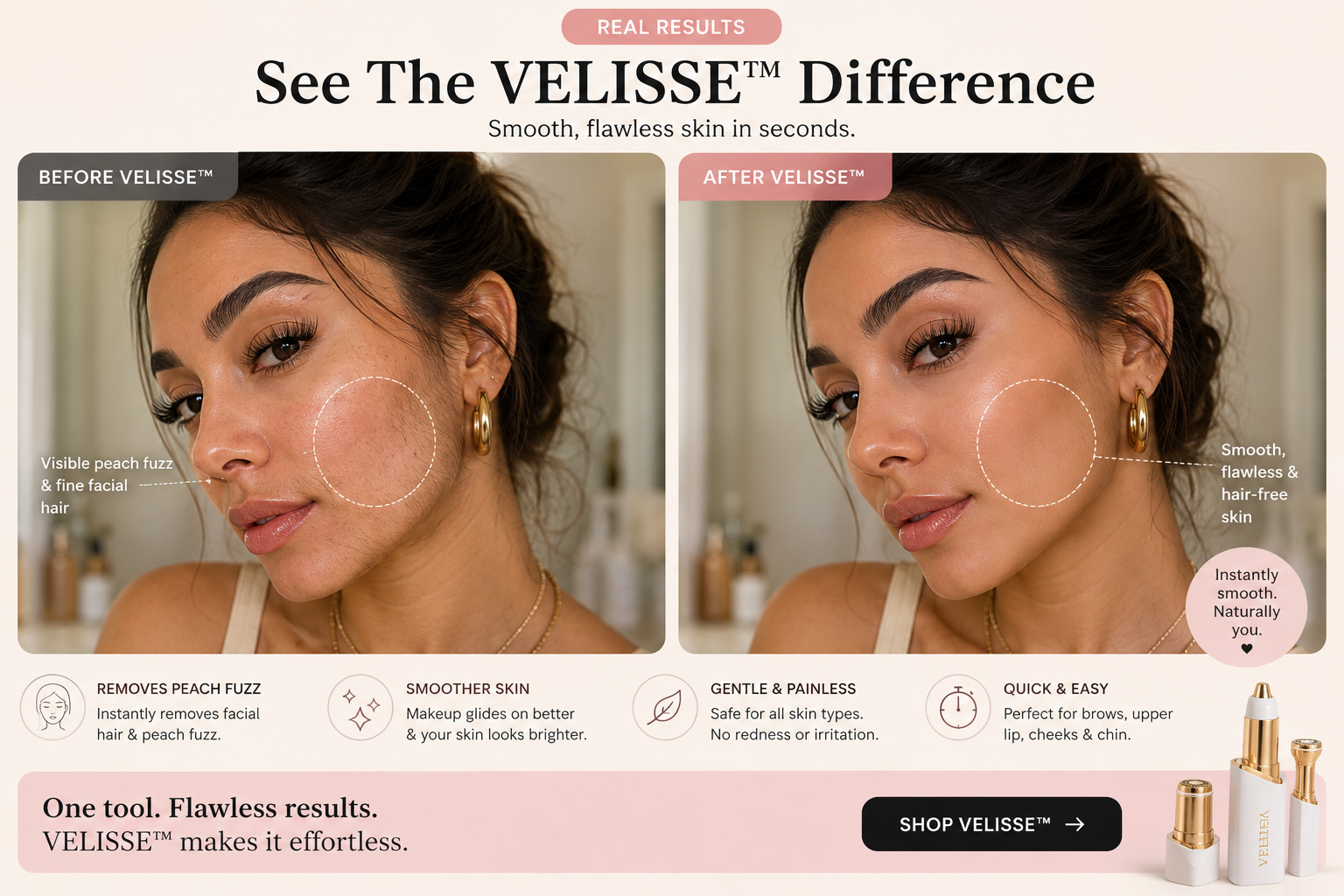 VELISSE before and after visualization